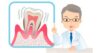 Подвижность зубов, лечение подвижности зубов